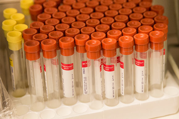 Phlebotomy Technician Program at NewBridge Cleveland