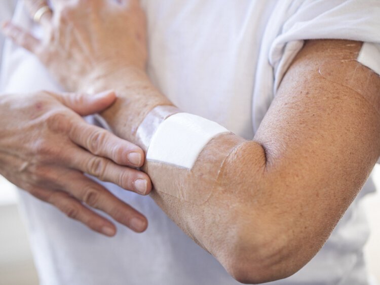 DelDerm developed easily removable bandages for use in hospitals, long-term care facilities, and other medical settings.